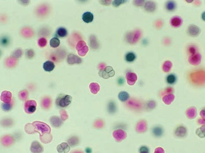 Defect Analysis using FT-IR Microscopy